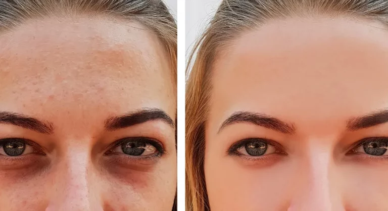 How to Sharpen an Image