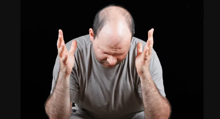 Hair Loss