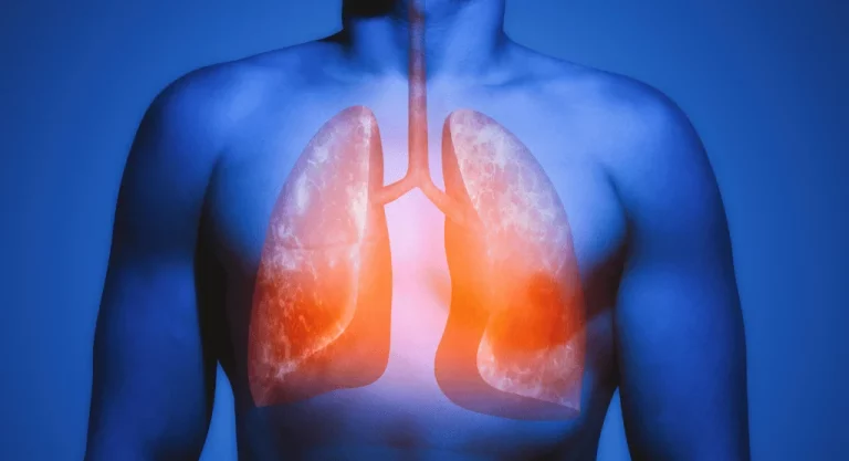 Healthy Lungs