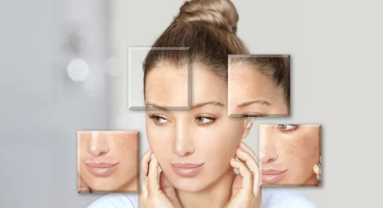 Skin Whitening Cream