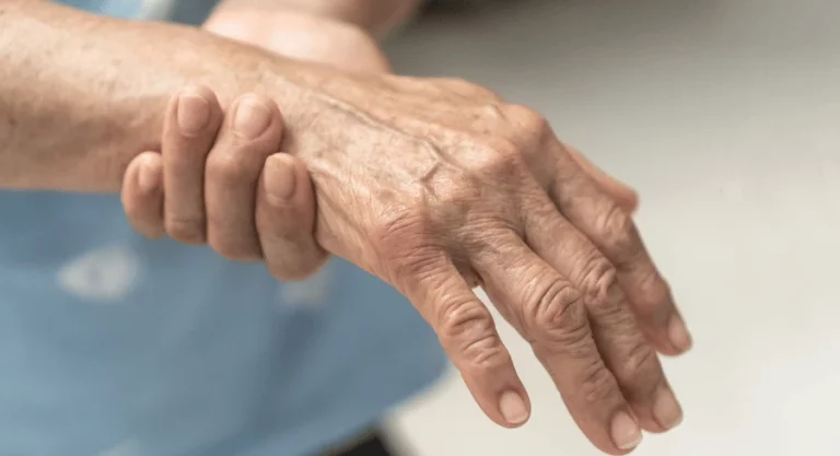 Peripheral Neuropathy
