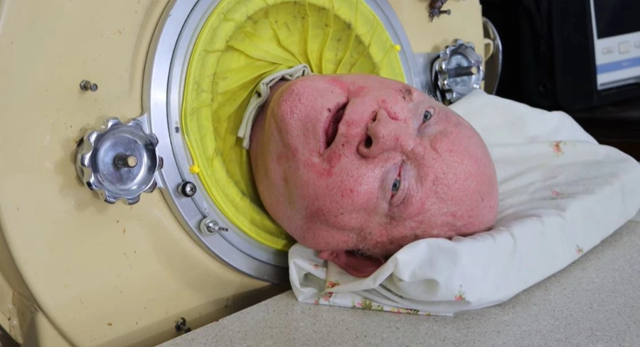 Paul Alexander, iron lung