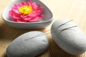 Acupuncture Clinic for Pain Management and Wellness