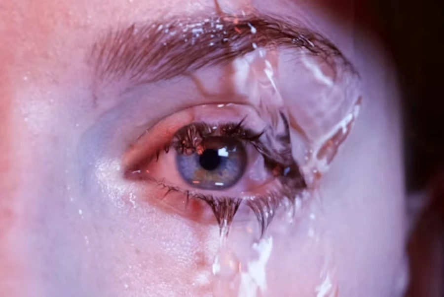 Under-Eye Wrinkle Treatments